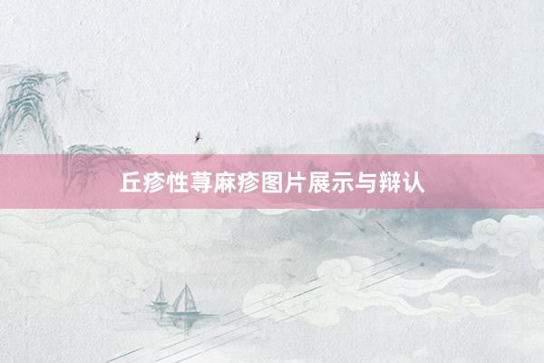 丘疹性荨麻疹图片展示与辩认
